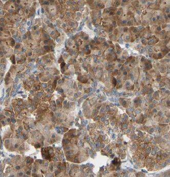 GSTO1 Antibody (9H4)