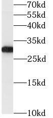 GSTO1 Antibody (9H4)