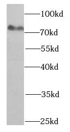HADHA Antibody (6A0)