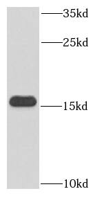 Hemoglobin epsilon Antibody (6G7)