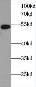 Heparanase/HPSE Antibody (0C0)