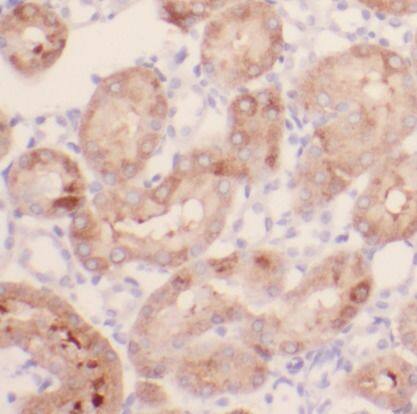 IFT88 Antibody (2B2)