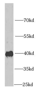 IGBP1 Antibody (6E3)