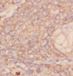 IVD Antibody (5F5)