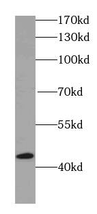 IVD Antibody (5F5)