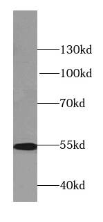 LPCAT1 Antibody (7E4)