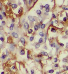 LPCAT1 Antibody (7E4)