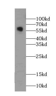 Monoamine Oxidase B Antibody (8E0)