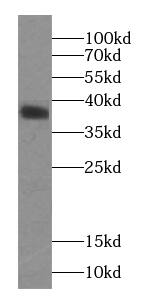MAP3K12 binding inhibitory protein 1 Antibody (8G3)