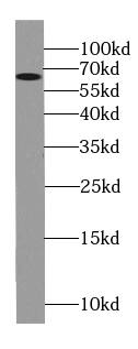 Melanophilin Antibody (8B2)