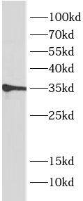 MEST Antibody (5E0)