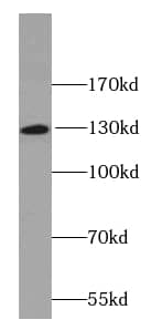 O-GlcNAcase/OGA/MGEA5 Antibody (9B9)