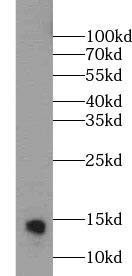 MGP Antibody (8C3)