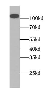 MMS19 like protein Antibody (6H1)