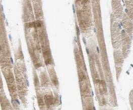 Myosin heavy chain 2 Antibody (4G9)