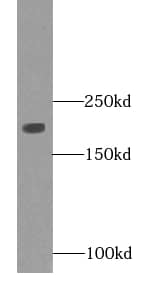 Myosin heavy chain 2 Antibody (4G9)