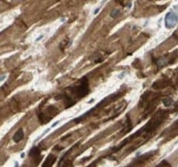 Myosin Light Chain 2 Antibody (1F7)