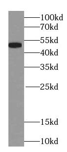 NAPRT1 Antibody (0C6)