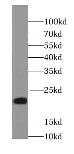 NCALD Antibody (9G5)