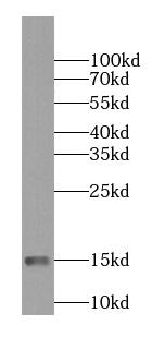 NDUFS5 Antibody (5C2)
