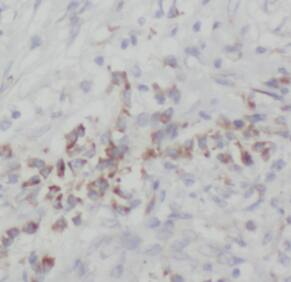 NOB1 Antibody (8G0)