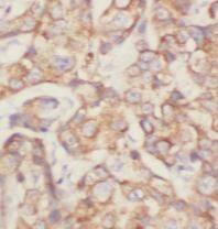 P4HA1 Antibody (4F1)