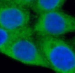 P4HA1 Antibody (4F1)