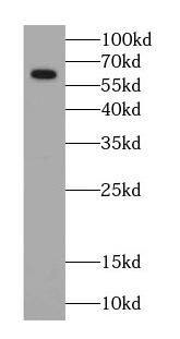 P4HA1 Antibody (4F1)