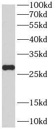 PCMT1 Antibody (7G6)