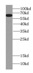 PGM1 Antibody (0F6)