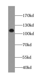 EGFLAM Antibody (5A5)