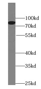 PLAP Antibody (8F0)