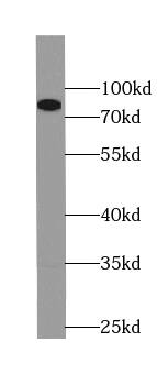 PLOD3 Antibody (2B1)