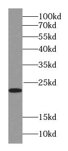 RAB18 Antibody (1G11)