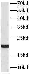 RAC2 Antibody (8F0)