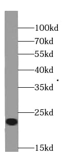 RBBP9 Antibody (0B7)