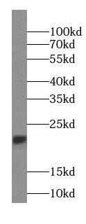 RBBP9 Antibody (7E10)