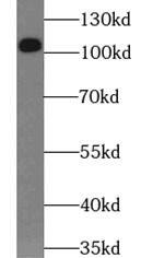 RBM15 Antibody (6B1)