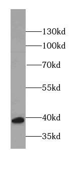 RBM4 Antibody (6F6)