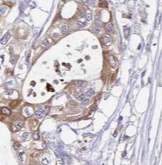 RISC Antibody (1C4)