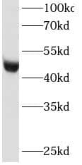 Ribonuclease Inhibitor Antibody (0H7)