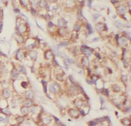 EXOC2 Antibody (0H2)