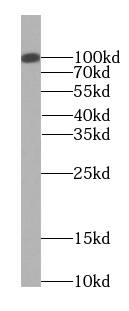 EXOC2 Antibody (0H2)