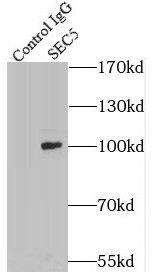 EXOC2 Antibody (0H2)