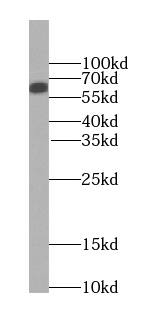 SMARCD1 Antibody (1A7)