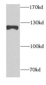 SND1 Antibody (0A1)