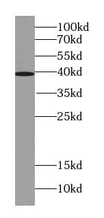 ST6 Sialyltransferase 6/ST6GALNAC6 Antibody (1F4)