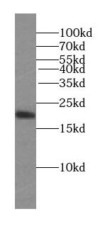 STMN3 Antibody (6D5)