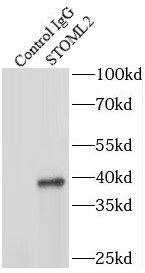 SLP-2 Antibody (5D10)