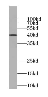 TMEM106B Antibody (6H1)